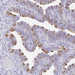CAPSL Antibody, Novus Biologicals:Antibodies:Primary Antibodies