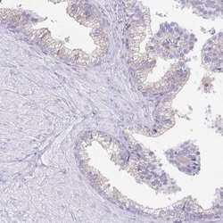 CAPSL Antibody, Novus Biologicals:Antibodies:Primary Antibodies