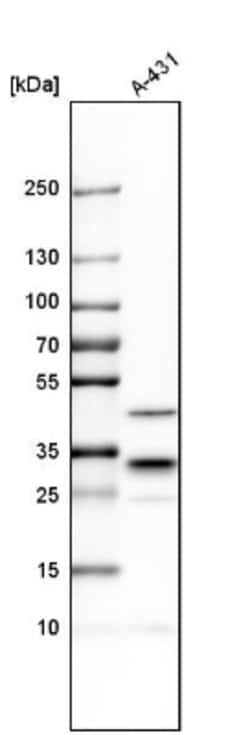 CAPZB Antibody, Novus Biologicals:Antibodies:Primary Antibodies