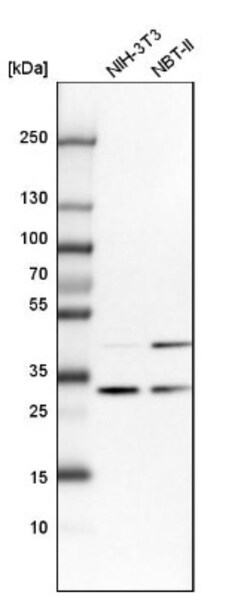 CAPZB Antibody, Novus Biologicals:Antibodies:Primary Antibodies