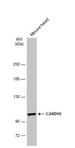 CARD10 Antibody, Novus Biologicals 0.1mg; Unlabeled:Antibodies, Polyclonal