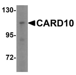 CARD10 Antibody - BSA Free, Novus Biologicals 0.1mg; Unlabeled:Antibodies,