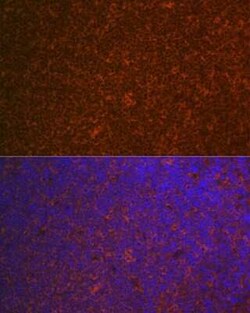 CARD11/CARMA1 Rabbit anti-Human, Mouse, Rat, Clone: 8N4C9, Novus Biologicals:Antibodies:Primary