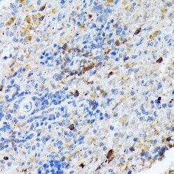 CARD11/CARMA1 Rabbit anti-Human, Mouse, Rat, Clone: 8N4C9, Novus Biologicals:Antibodies:Primary
