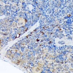 CARD11/CARMA1 Rabbit anti-Human, Mouse, Rat, Clone: 8N4C9, Novus Biologicals:Antibodies:Primary