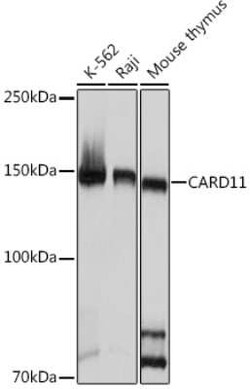 CARD11/CARMA1 Rabbit anti-Human, Mouse, Rat, Clone: 8N4C9, Novus Biologicals:Antibodies:Primary