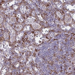 CARD9 Antibody, Novus Biologicals:Antibodies:Primary Antibodies