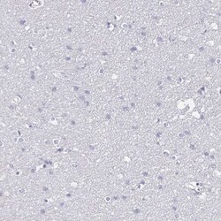 CARD9 Antibody, Novus Biologicals:Antibodies:Primary Antibodies