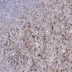 CARD9 Antibody, Novus Biologicals:Antibodies:Primary Antibodies