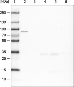 CARS Antibody (CL2302), Novus Biologicals:Antibodies:Primary Antibodies