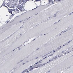 CARS Antibody, Novus Biologicals 25 &mu;L; Unlabeled:Antibodies, Polyclonal