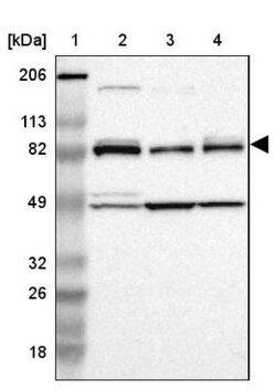 CARS Antibody, Novus Biologicals 25 &mu;L; Unlabeled:Antibodies, Polyclonal