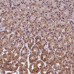 CARS2 Antibody, Novus Biologicals:Antibodies:Primary Antibodies