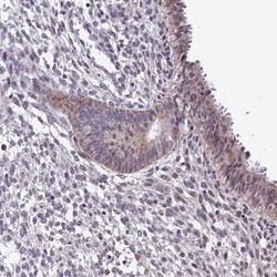 CARS2 Antibody, Novus Biologicals:Antibodies:Primary Antibodies