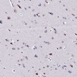 CARS2 Antibody, Novus Biologicals:Antibodies:Primary Antibodies