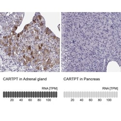 CART/CARTPT Antibody, Novus Biologicals 0.1mL; Unlabeled:Antibodies, Polyclonal
