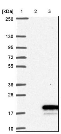 CART/CARTPT Antibody, Novus Biologicals 0.1mL; Unlabeled:Antibodies, Polyclonal