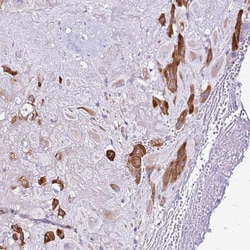 CASD1 Antibody, Novus Biologicals:Antibodies:Primary Antibodies