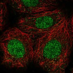 CASK Interacting Protein 1 Antibody, Novus Biologicals 0.1mL; Unlabeled:Antibodies,