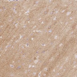 CASK Interacting Protein 1 Antibody, Novus Biologicals 0.1mL; Unlabeled:Antibodies,