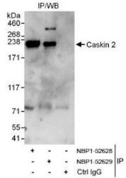 CASKIN2 Antibody, Novus Biologicals 0.1mg; Unlabeled:Antibodies, Polyclonal