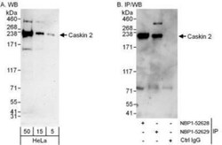 CASKIN2 Antibody, Novus Biologicals 0.1mg; Unlabeled:Antibodies, Polyclonal