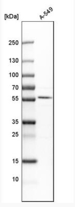 CBARA1 Antibody, Novus Biologicals 0.1mL; Unlabeled:Antibodies, Polyclonal