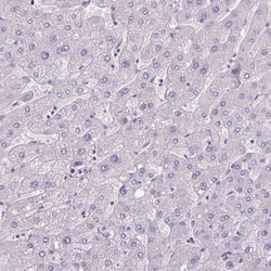 CBE1 Antibody, Novus Biologicals 0.1mL; Unlabeled:Antibodies, Polyclonal