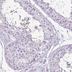 CBE1 Antibody, Novus Biologicals 0.1mL; Unlabeled:Antibodies, Polyclonal