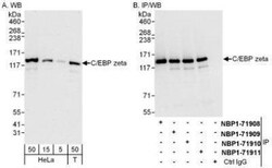 CBF2 Antibody, Novus Biologicals 0.1mL; Unlabeled:Antibodies, Polyclonal