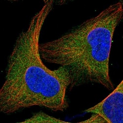 CBL Antibody, Novus Biologicals 0.1mL; Unlabeled:Antibodies, Polyclonal