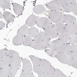 CBL Antibody, Novus Biologicals 0.1mL; Unlabeled:Antibodies, Polyclonal