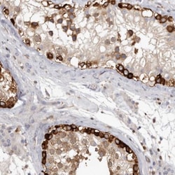 CBL Antibody, Novus Biologicals 0.1mL; Unlabeled:Antibodies, Polyclonal