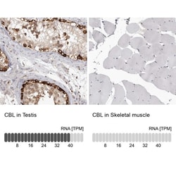 CBL Antibody, Novus Biologicals 0.1mL; Unlabeled:Antibodies, Polyclonal