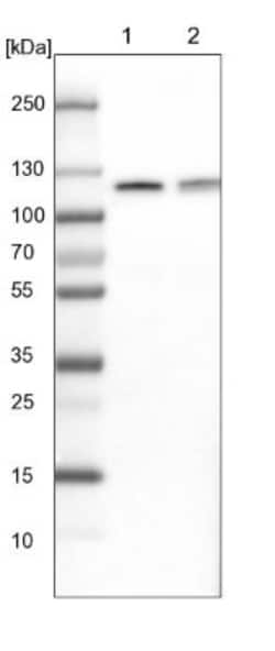 CBL Antibody, Novus Biologicals 0.1mL; Unlabeled:Antibodies, Polyclonal