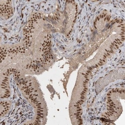 CBLL1 Antibody, Novus Biologicals 25 &mu;L; Unlabeled:Antibodies, Polyclonal