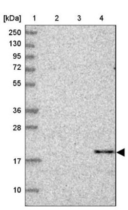 CBLN3 Antibody, Novus Biologicals 0.1mL; Unlabeled:Antibodies, Polyclonal