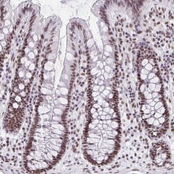 CBP/KAT3A Antibody, Novus Biologicals 0.1mL; Unlabeled:Antibodies, Polyclonal