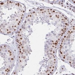 CBP/KAT3A Antibody, Novus Biologicals 0.1mL; Unlabeled:Antibodies, Polyclonal