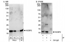 CBP20 Antibody, Novus Biologicals 0.1mg; Unlabeled:Antibodies, Polyclonal