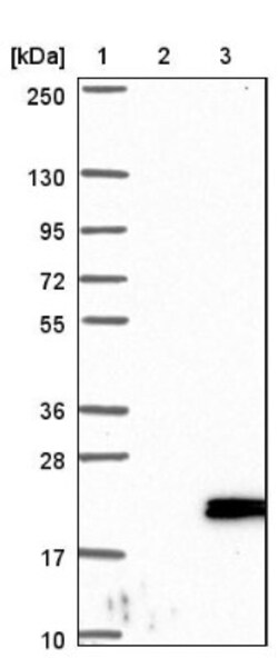anti-CBP20, Polyclonal, Novus Biologicals 0.1mL; Unlabeled:Antibodies,