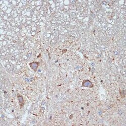 CBR1 Rabbit anti-Human, Mouse, Rat, Clone: 3A9O5, Novus Biologicals 100