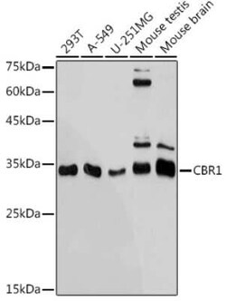 CBR1 Rabbit anti-Human, Mouse, Rat, Clone: 3A9O5, Novus Biologicals 100