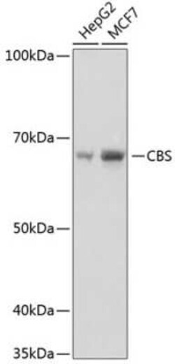 CBS Rabbit anti-Human, Mouse, Rat, Clone: 1R2E9, Novus Biologicals 20 &mu;g | Buy Online | Novus Biologicals | Fisher Scientific