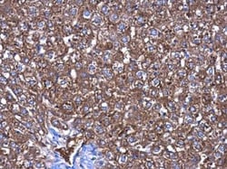 CBS Antibody (519), Novus Biologicals 0.1mL; Unlabeled:Antibodies, Monoclonal