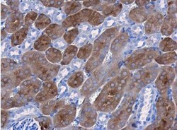 CBS Antibody (519), Novus Biologicals 0.1mL; Unlabeled:Antibodies, Monoclonal