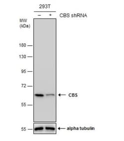 CBS Antibody (519), Novus Biologicals 0.1mL; Unlabeled:Antibodies, Monoclonal