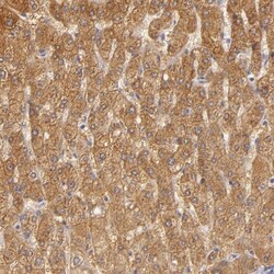 CBS Antibody, Novus Biologicals 25 &mu;L; Unlabeled:Antibodies, Polyclonal