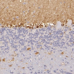 CBS Antibody, Novus Biologicals 25 &mu;L; Unlabeled:Antibodies, Polyclonal
