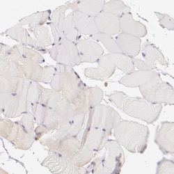 CBS Antibody, Novus Biologicals 25 &mu;L; Unlabeled:Antibodies, Polyclonal